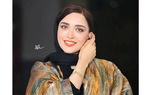 عکس جدید بهنوش طباطبایی بعد عمل های عروسکی / ناز ترین خانم بازیگر ایران شد!